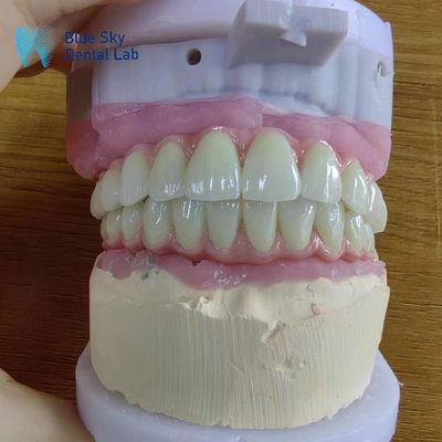 شراء التوافق العالمي الجسر المعدني الملو مع إطار التيتانيوم النقي online manufacture