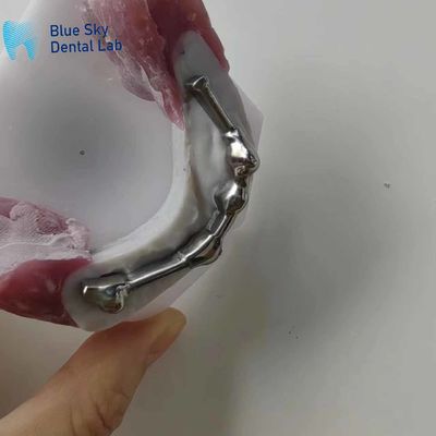 شراء شريط التيتانيوم للأسنان القابل للتعديل مع أسنان العصا لأسنان الاصطناعية online manufacture