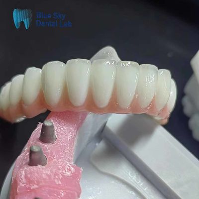 شراء غلاف غرسات الزركونيا العادي غلاف غرسات أسنان شخصية online manufacture