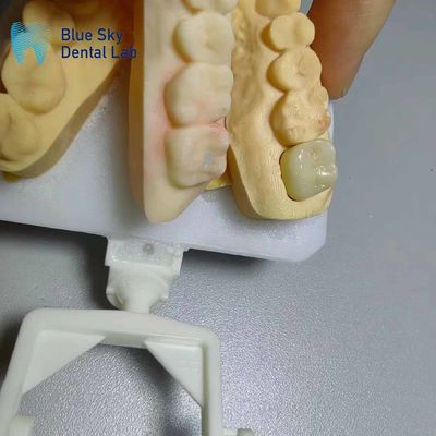 شراء تاج زيركونيا مقاوم للتآكل أسنان زيركونيا ذات مظهر طبيعي online manufacture