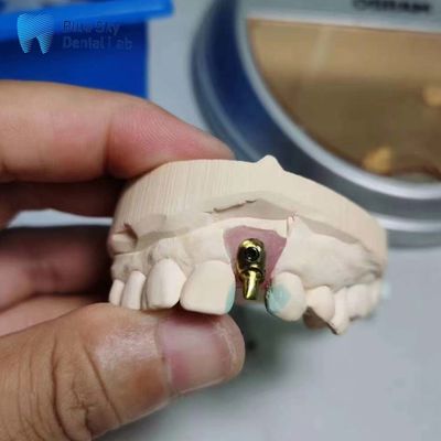شراء حقائب الزرع العادية القابلة للتخصيص لزرع الأسنان الفردي online manufacture