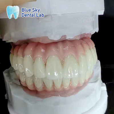 شراء حالة زرع الأسنان العادية الطبيعة والمتانة للمعدات الطبية online manufacture