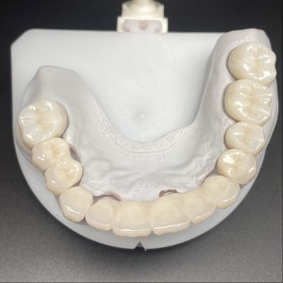شراء جسر زيركونيا طبقات للترميم الثابت ابتسامات جميلة محترف مستقرة online manufacture