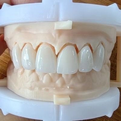 شراء الجمال الطبيعي الجسر التاجية الزركونيا طبقات لابتسامة جميلة واستعادة جيدة online manufacture