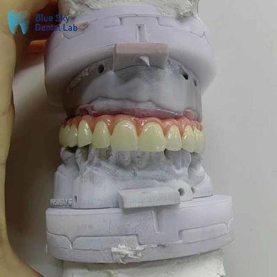 الطبيعة غطاء زرع الأسنان الاصطناعي غطاء زرع الفم الكامل