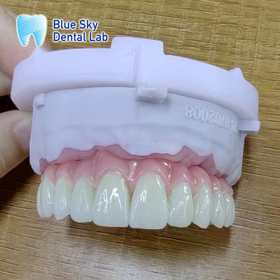 أغطية زرع مع سطح ناعم لتحقيق نتائج جراحية مثالية