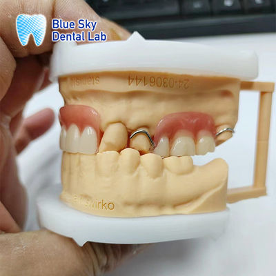 استعادة الابتسامة الأسنان الاكريليكية الجزئية مع المقبضات
